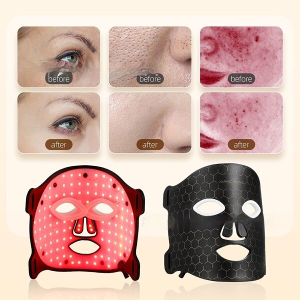 Led Pull Firming Phototherapy Silicone Mask Beauty Instrument Charging Mask USB - Image 3